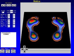 esame baropodostatico 
